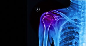 What Is the Average Settlement for Shoulder Surgery After Car Accident?