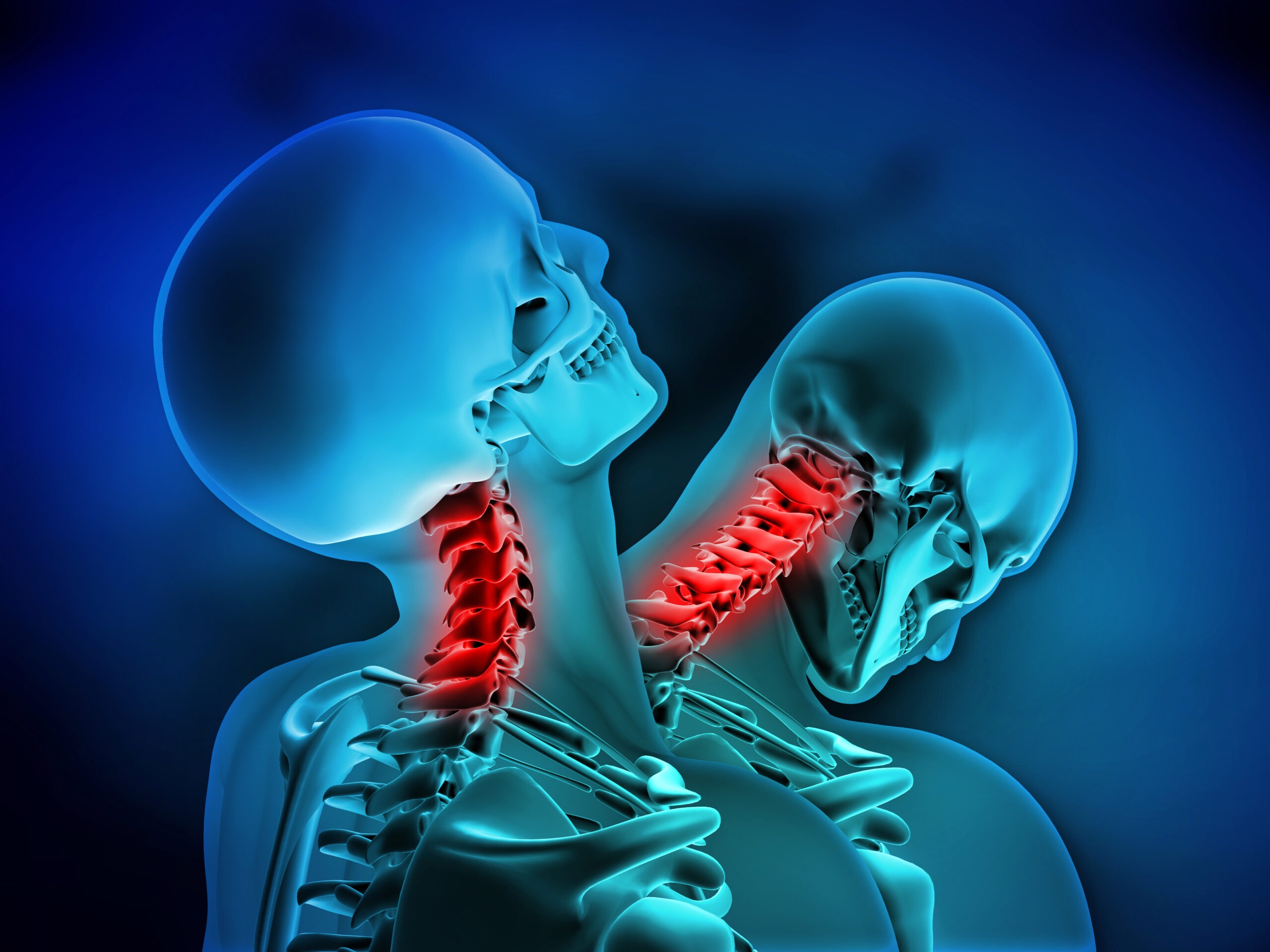 What Should I Do if I Suffered Whiplash After a Motorcycle Accident?